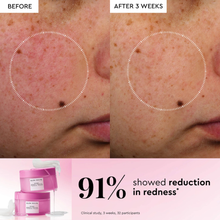 Cargar imagen en el visor de la galería, Glow Recipe PDRN Repair + Soothe Korean Prickly Pear Toner Pads for Skin Barrier Repair *PRE-Order*
